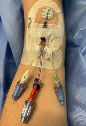 vascular access team