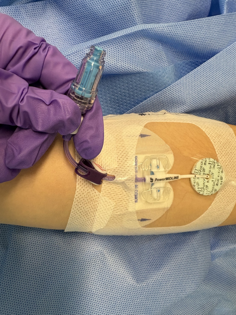 how long can a central line stay in place